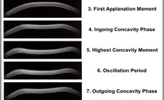 Exemplo da sequência de imagens usadas para o diagnóstico. Fonte: Revista Brasileira de Oftalmologia