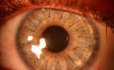 Imagem recebida do equipamento. Foto: Arquivo pessoal do pesquisador