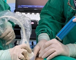 HU realiza primeira biópsia renal infantil guiada por ultrassonografia