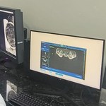 HU agora conta com sistema digital para armazenar exames de imagem