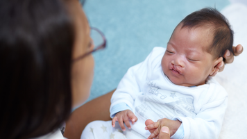 HU conta com unidade de tratamento para fissura labiopalatina