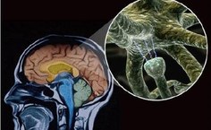 Ilustração da liberação dos neurotransmissores nas regiões sinápticas presentes no cérebro