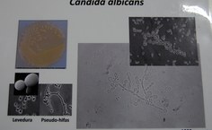 Imagem de Cândida Albicans causadora de infecções na cavidade oral e mucosa genital