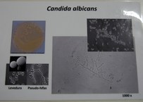 Imagem de Cândida Albicans causadora de infecções na cavidade oral e mucosa genital