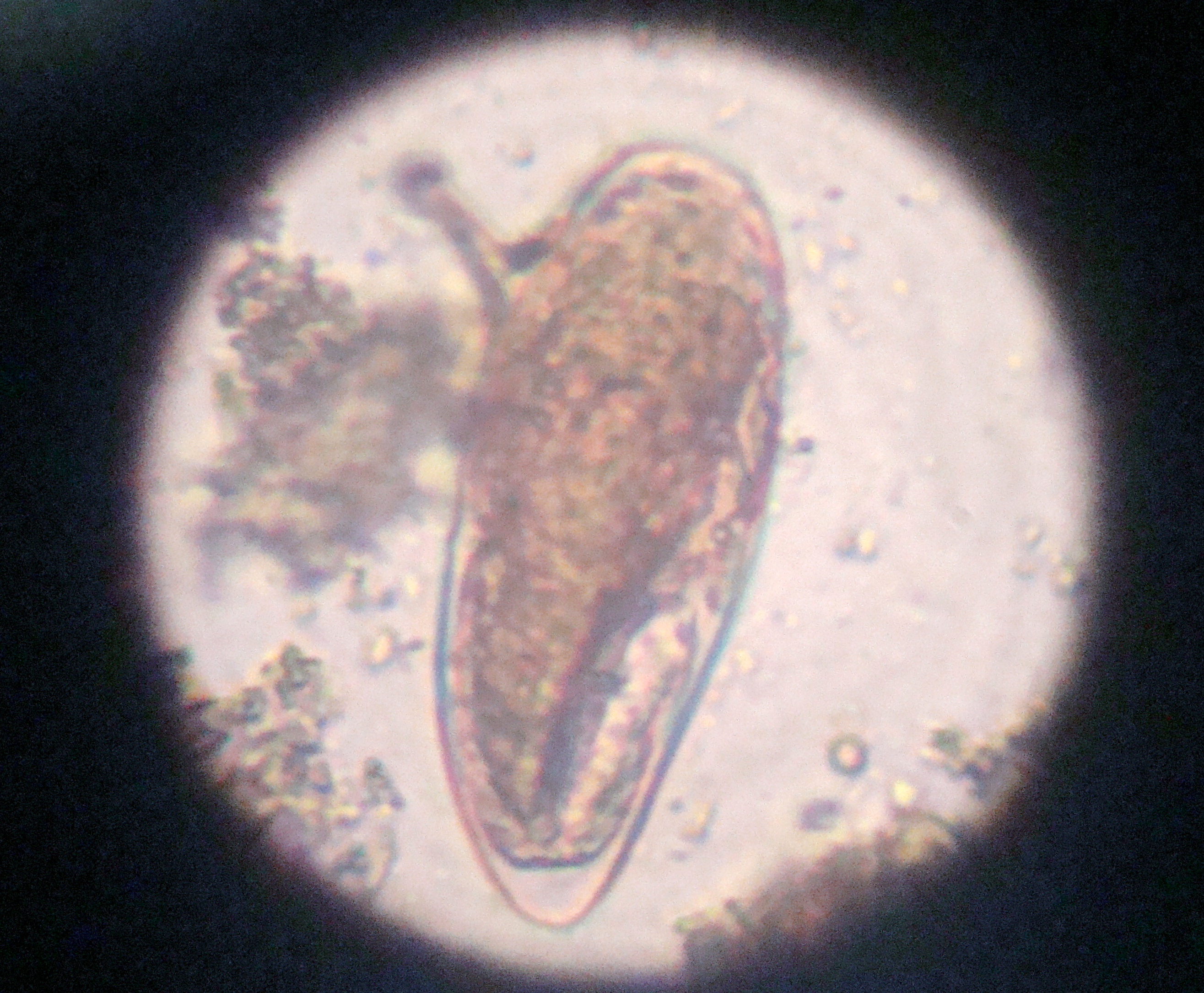 Ovo Do Schistosoma Mansoni