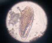 Imagem microscópica de ovo do Schistosoma mansoni