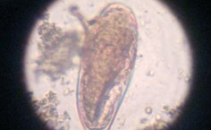 Imagem microscópica de ovo do Schistosoma mansoni