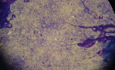 Citologia por imprint fotomicrografia de material coletado das lesões cutâneas do gato portador de esporotricose comprovando presença do fungo