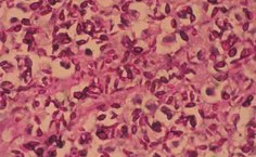 Histopatologico fotomicrografia de material cutâneo do do gato portador de esporotricose comprovando presença abundante do fungo