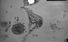 Microparasita de Carapeba