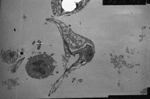 Microparasita de Carapeba