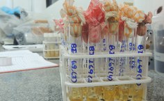 Amostras com micro-organismos isolados em meio de cultura líquida