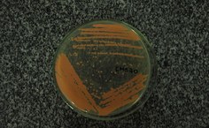 Placa com cultura de microorganismos coletados