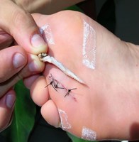 Estudo descreve impacto dos acidentes de trabalho na renda dos pescadores