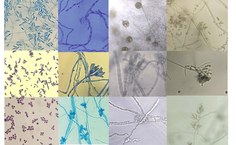 Alysson Duarte tem pesquisado os micro-organismos da Antártica desde a época do doutorado na USP com as leveduras do polo Sul para produção de enzimas lipases