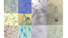 Alysson Duarte tem pesquisado os micro-organismos da Antártica desde a época do doutorado na USP com as leveduras do polo Sul para produção de enzimas lipases