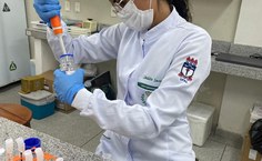 Os pesquisadores desenvolvem o projeto no Laboratório de Parasitologia (Labpar) da Ufal