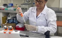 Os pesquisadores desenvolvem o projeto no Laboratório de Parasitologia (Labpar) da Ufal